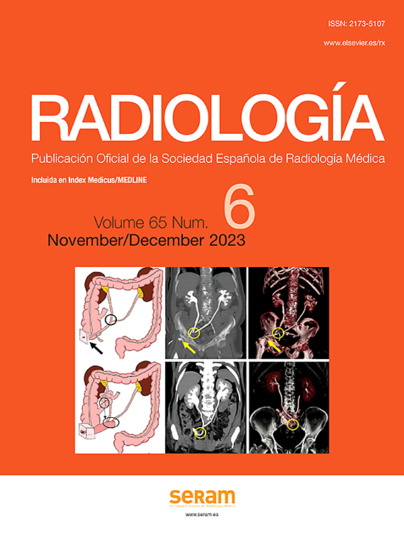 Go to journal home page - Radiología (English Edition)